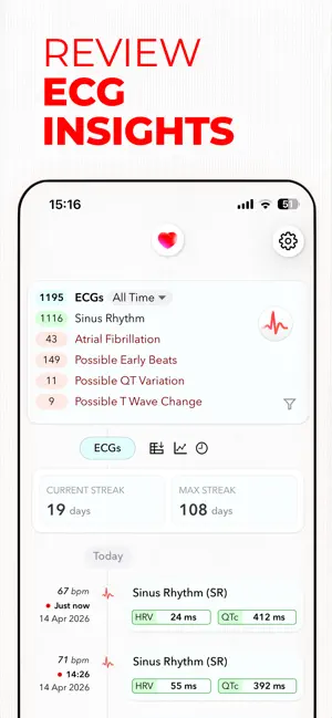 ECG+ | Analisi ECG smartwatch iPhone screenshot 2