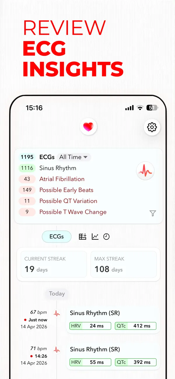 Screenshot #2 pour ECG+ | Analyse ton ECG Watch