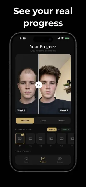 Root AI - Regrow Your Hair screenshot 2