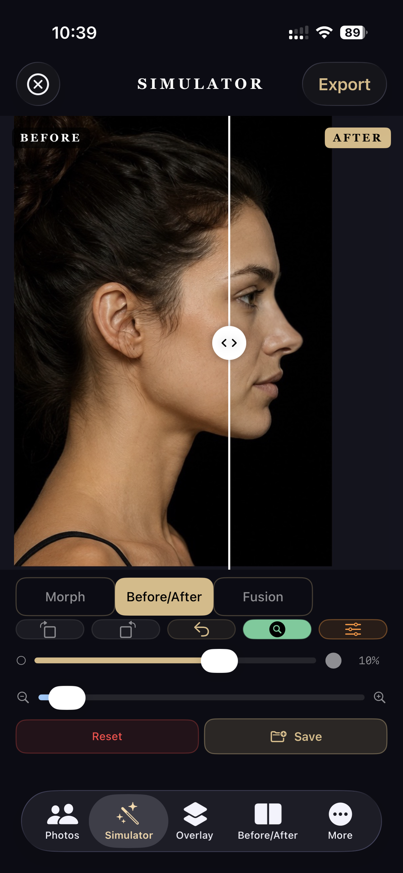 RhinoplastySimulator