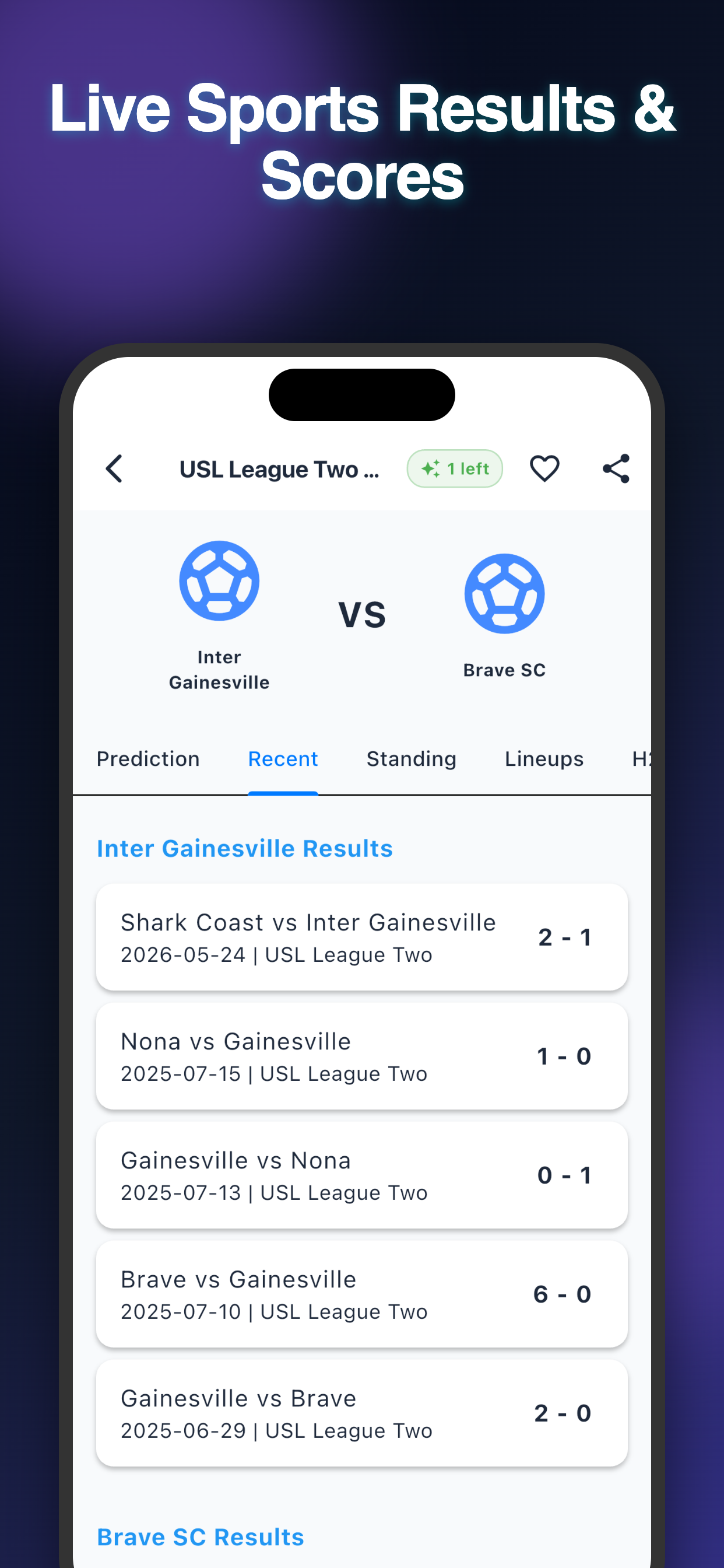 1x2 Bet Predictions Sportiq24