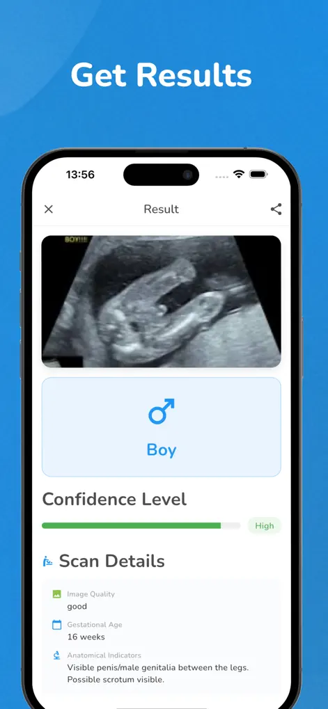 Baby Gender Scanner AI + - Health & Fitness App | MWM