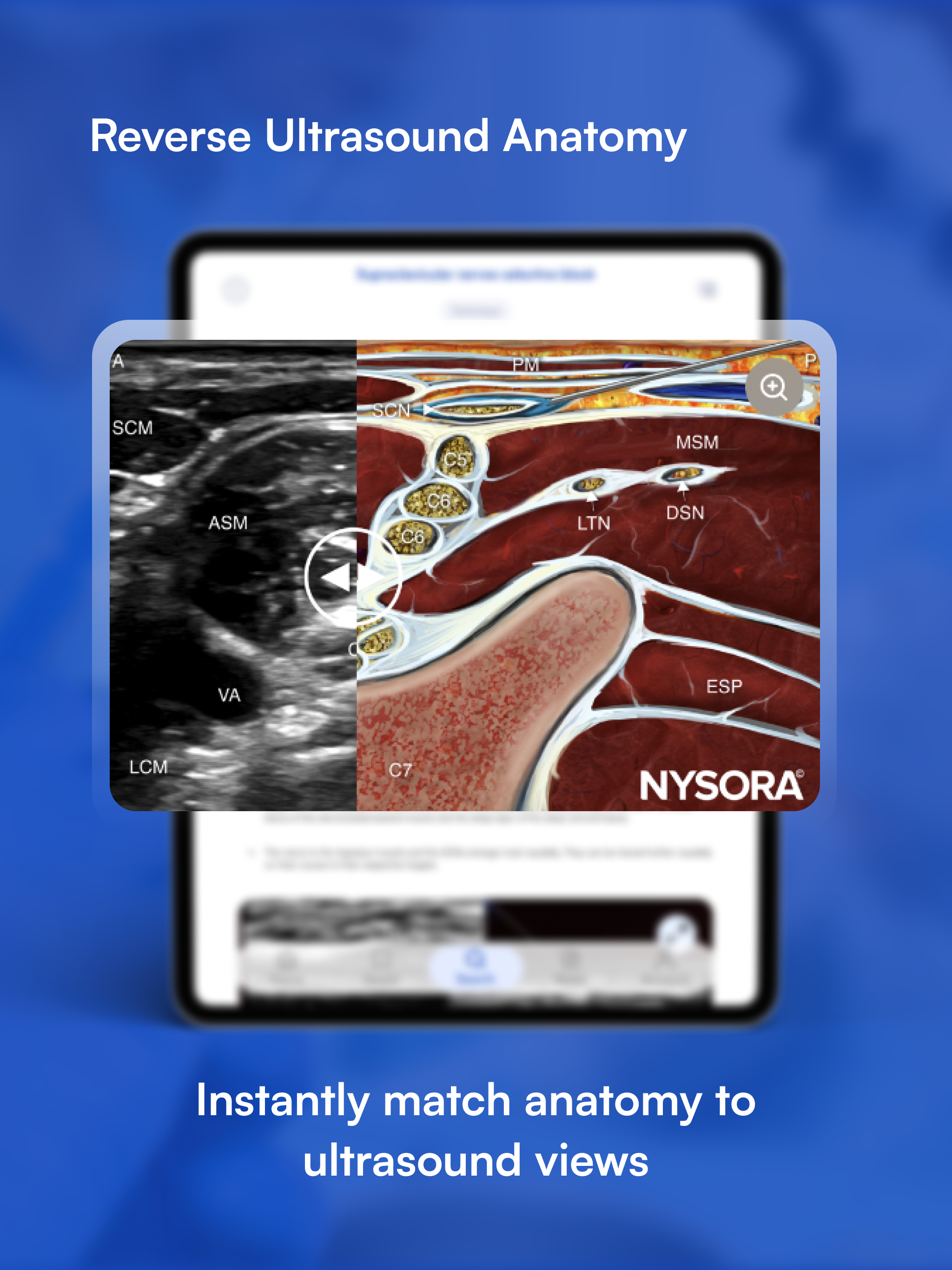 NYSORA Nerve Blocks