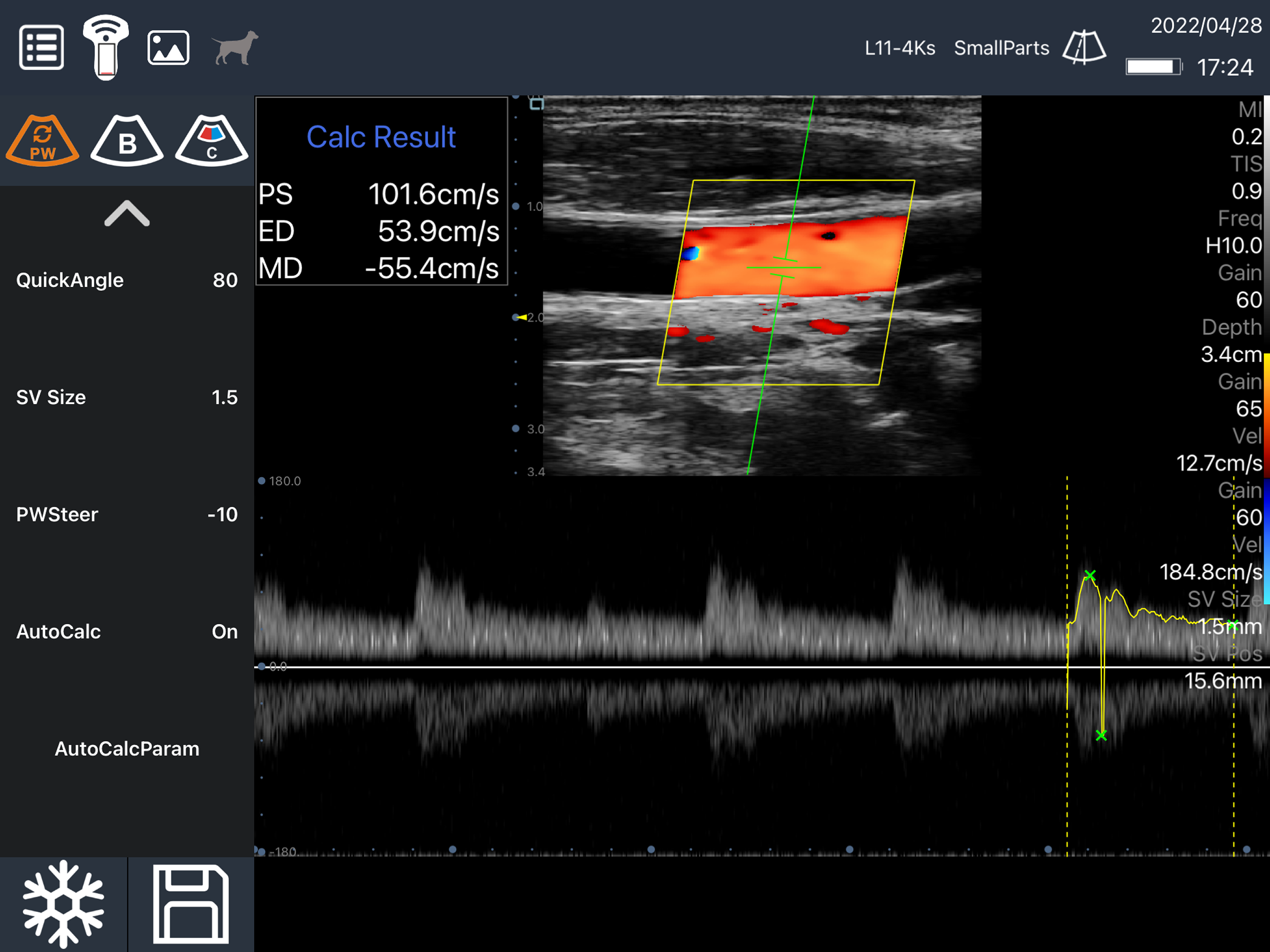 SonoiQ
