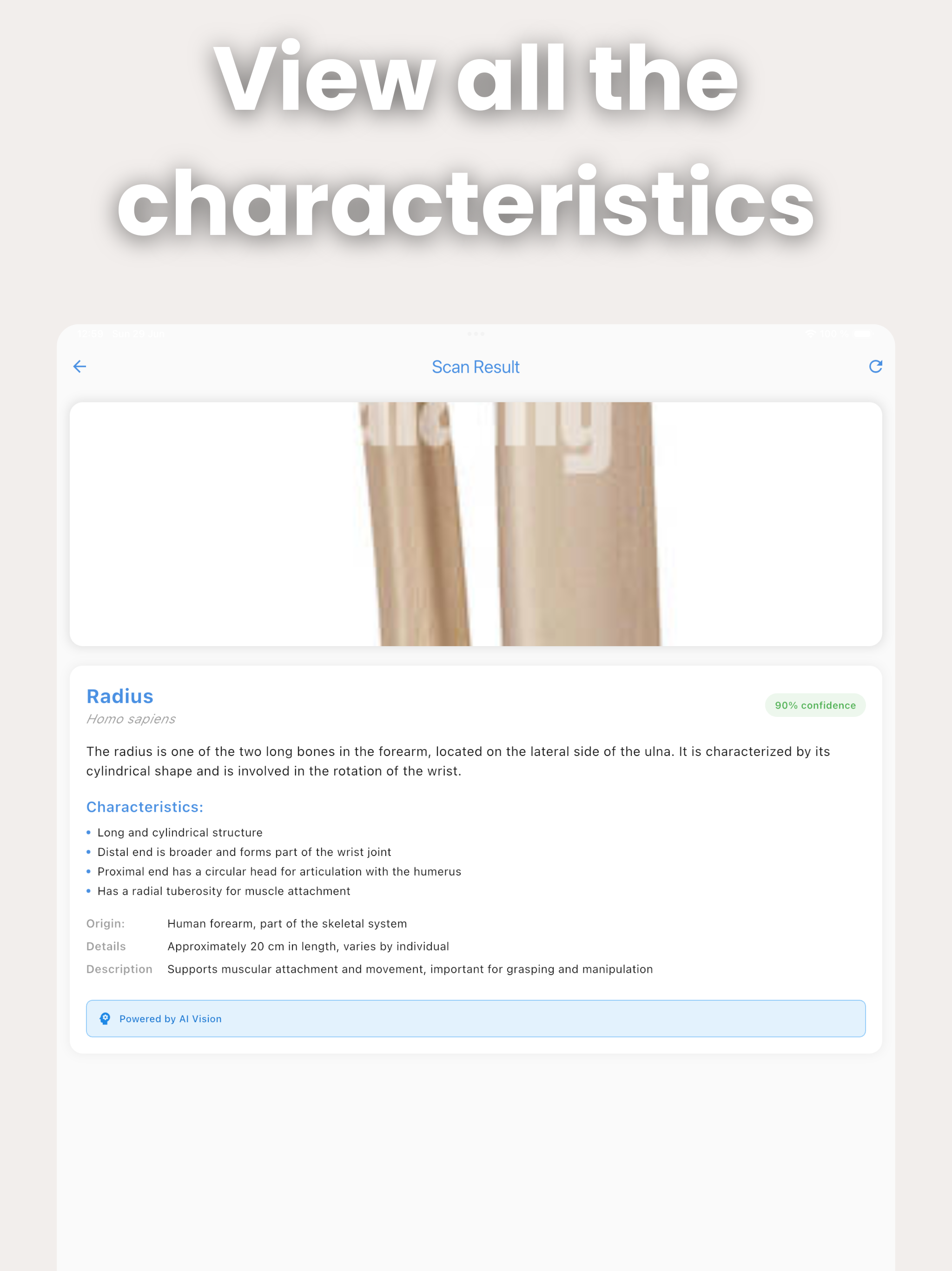 Bone Identifier: AI Scan