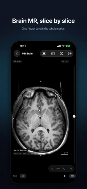 Voxelis: DICOM Viewer CT & MRI screenshot 2