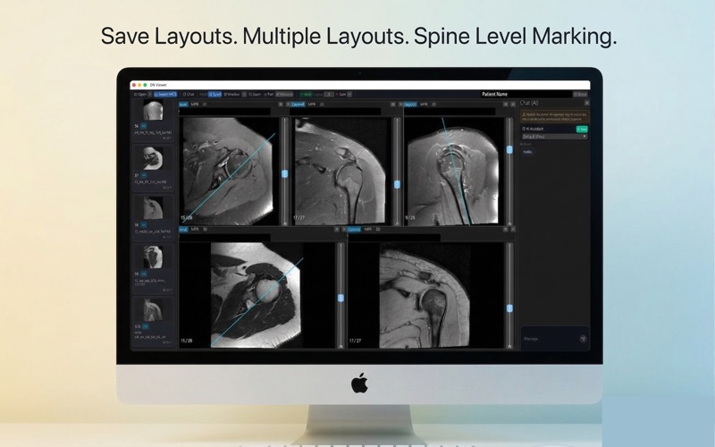 Donut DICOM Viewer screenshot