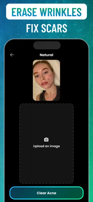 Blemish Remover&Acne: Acnefix screenshot 3