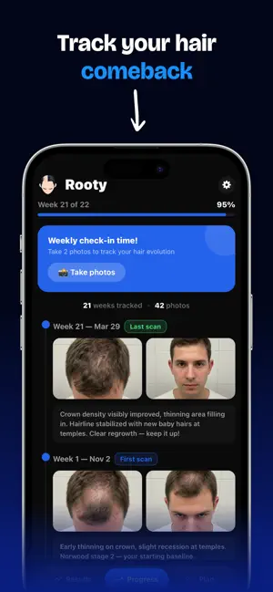 Rooty - Save Your Hair screenshot 2