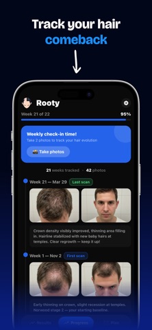 Rooty - Save Your Hair Screenshot 2 of 4