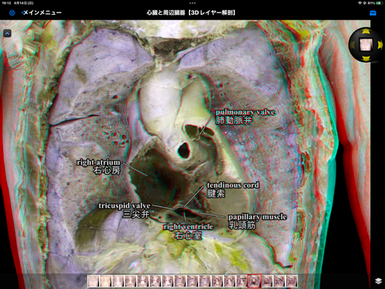 Screenshot #5 pour Medical KOS