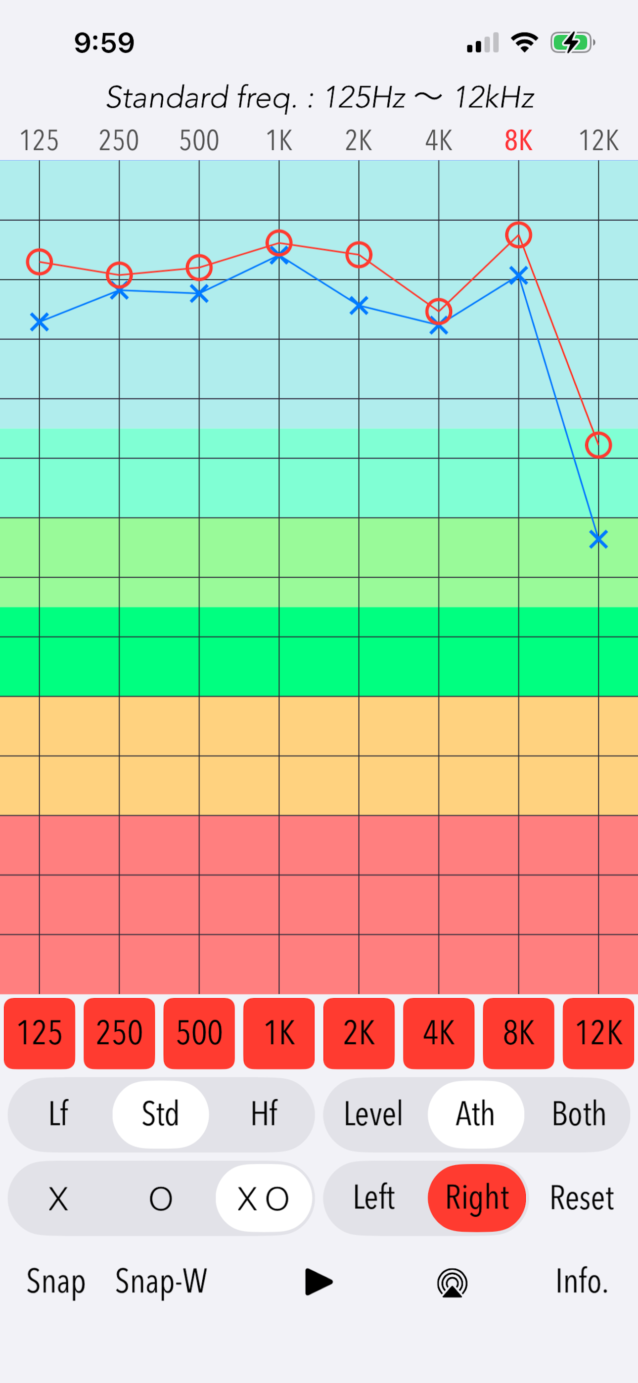 Hearing Analyzer Portrait