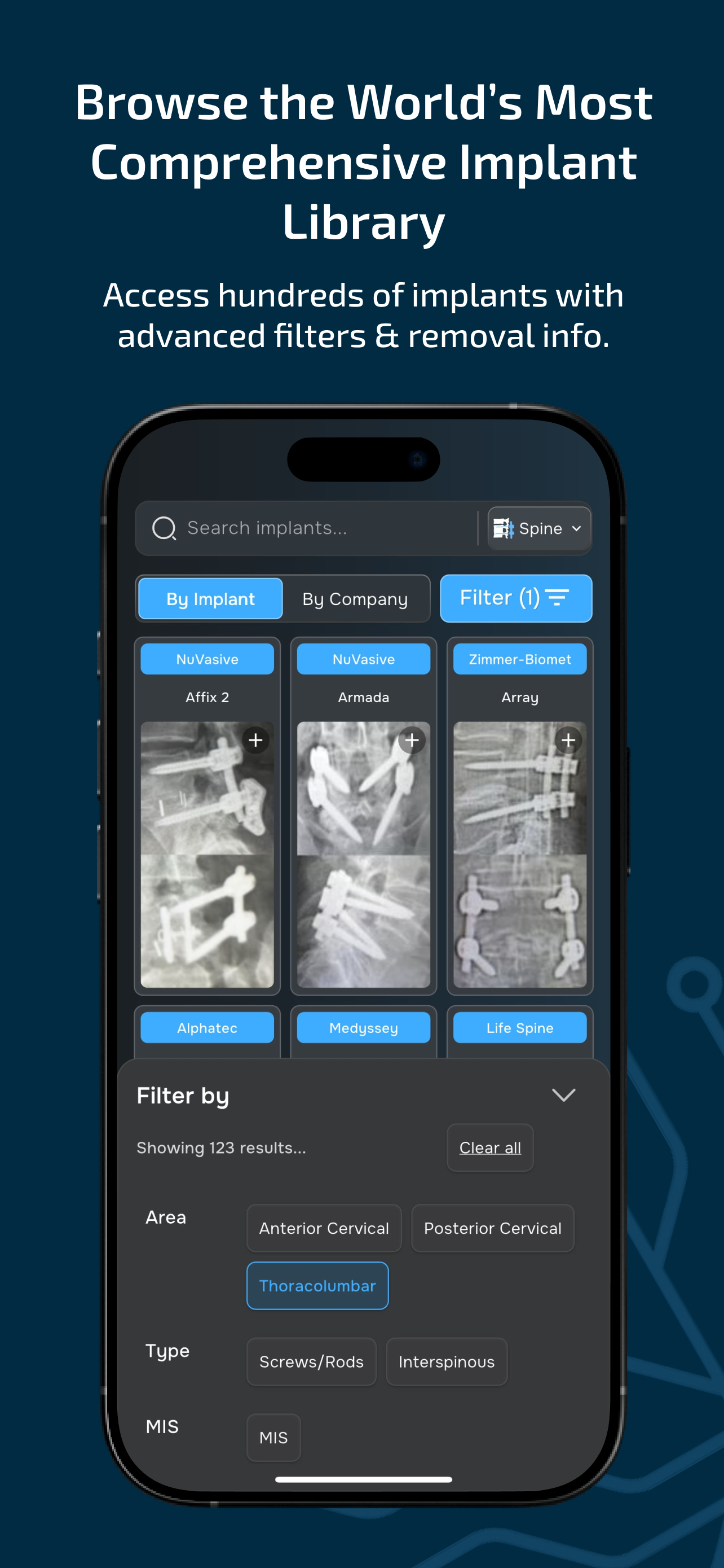 Implant Identifier
