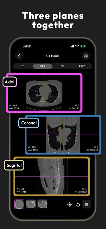 DICOM Viewer - MesDICOM screenshot 2 of 8