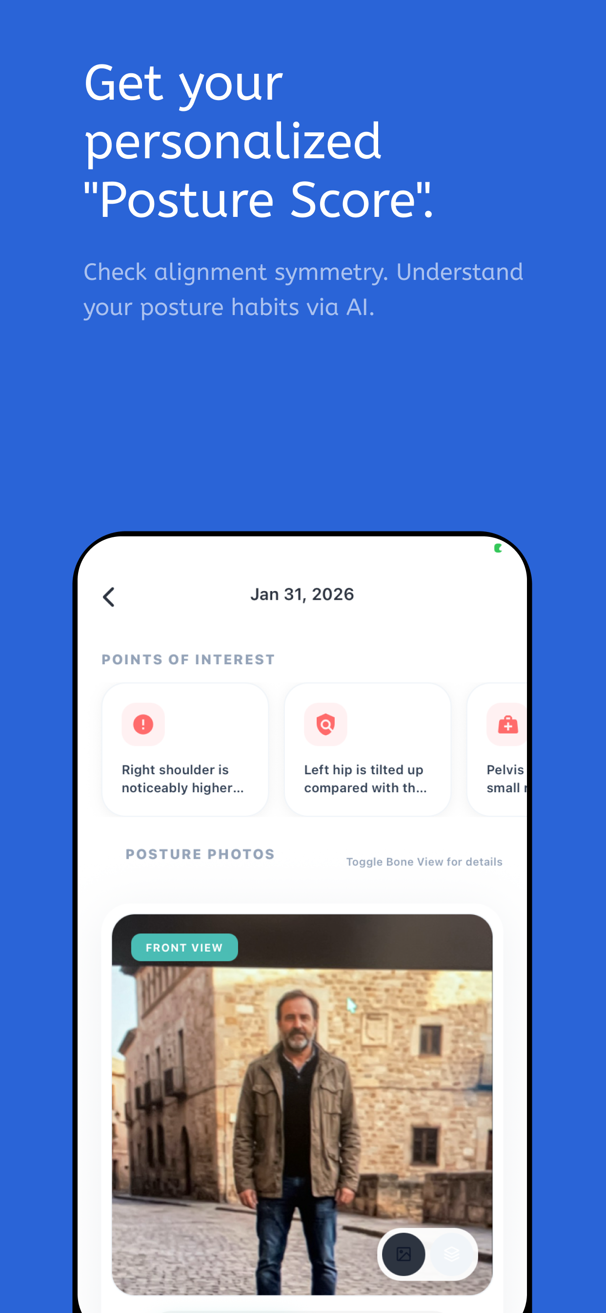 BioSkew: Body Check & Report