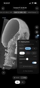 LumaDICOM: CT & MRI Viewer screenshot