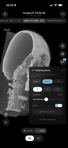LumaDICOM·CT MRI 阅片 screenshot