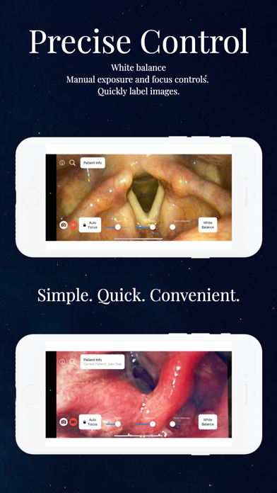 Endoscope App Screenshot