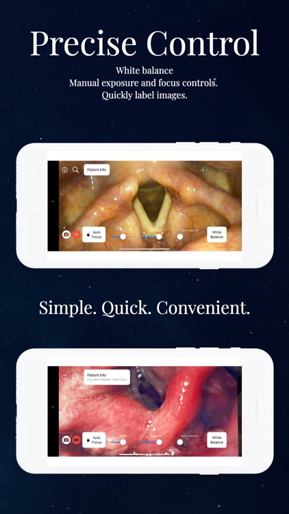 Endoscope App