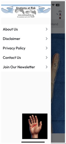 Anatomy at Risk screenshot