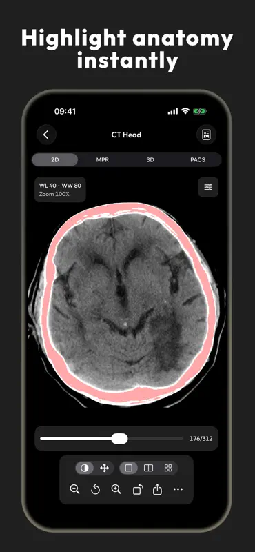 DICOM Viewer - MesDICOM screenshot 7 of 8