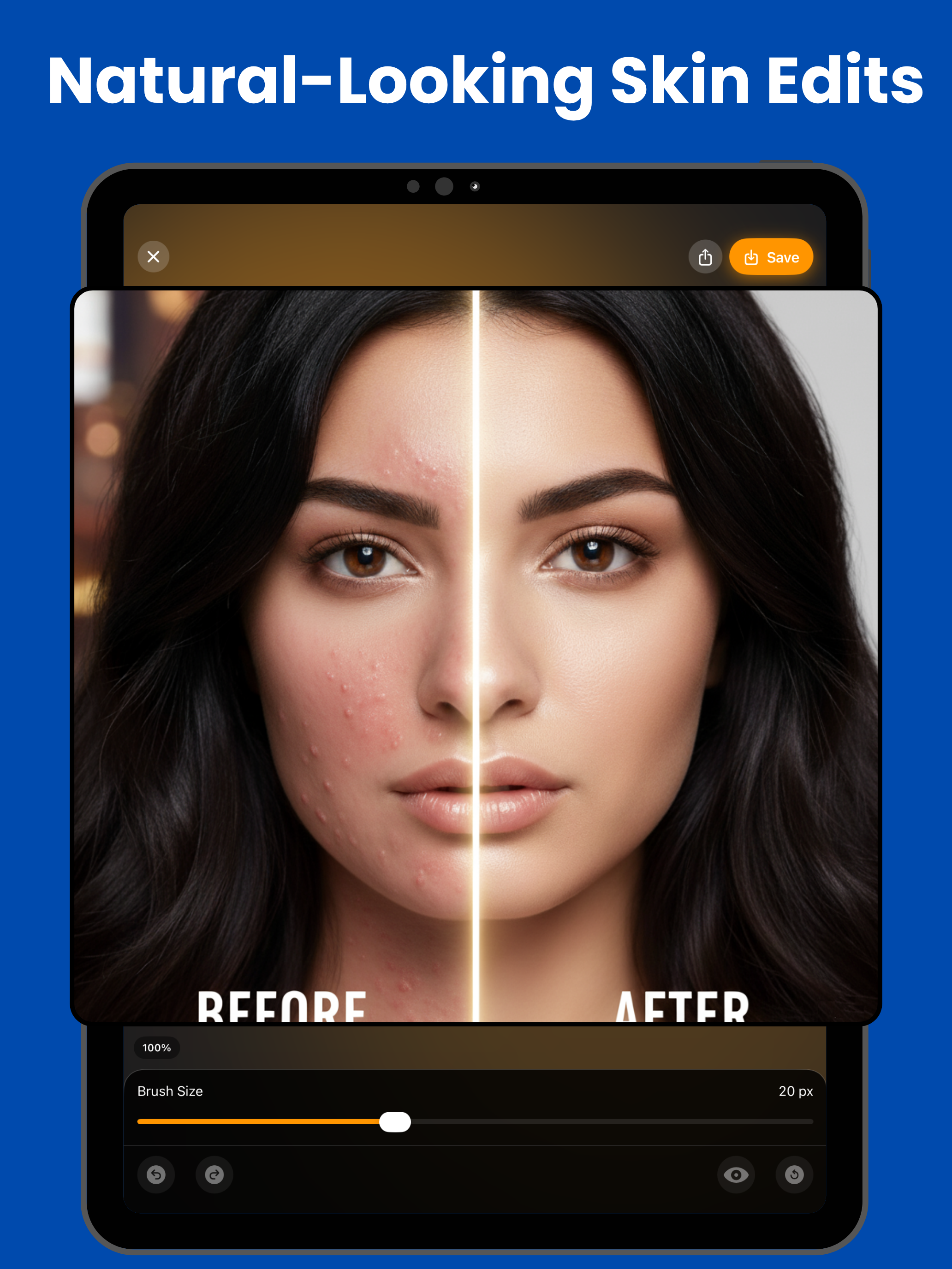 Acne Remover - Face Retouch screenshot 9