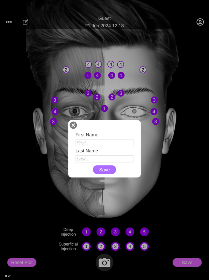 Face Injection Planner