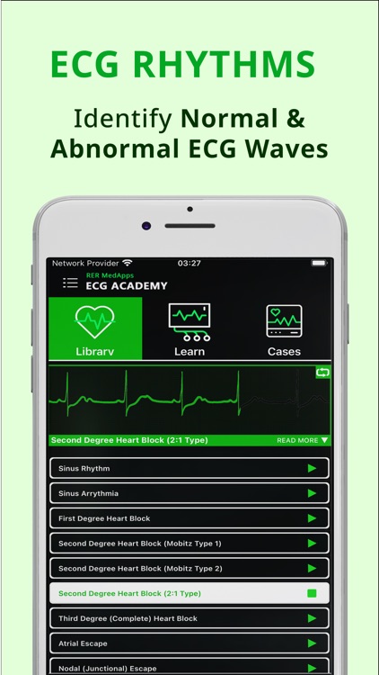 ECG Academy - Learn EKG Skills screenshot-3