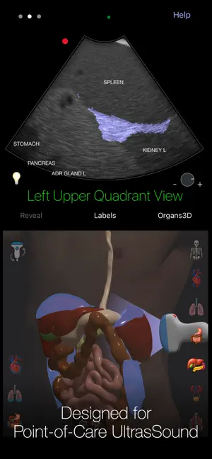 PoCUS Pocket Trainer screenshot 4