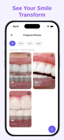 Aligner - TrackMyAligners Screenshot 4 of 5