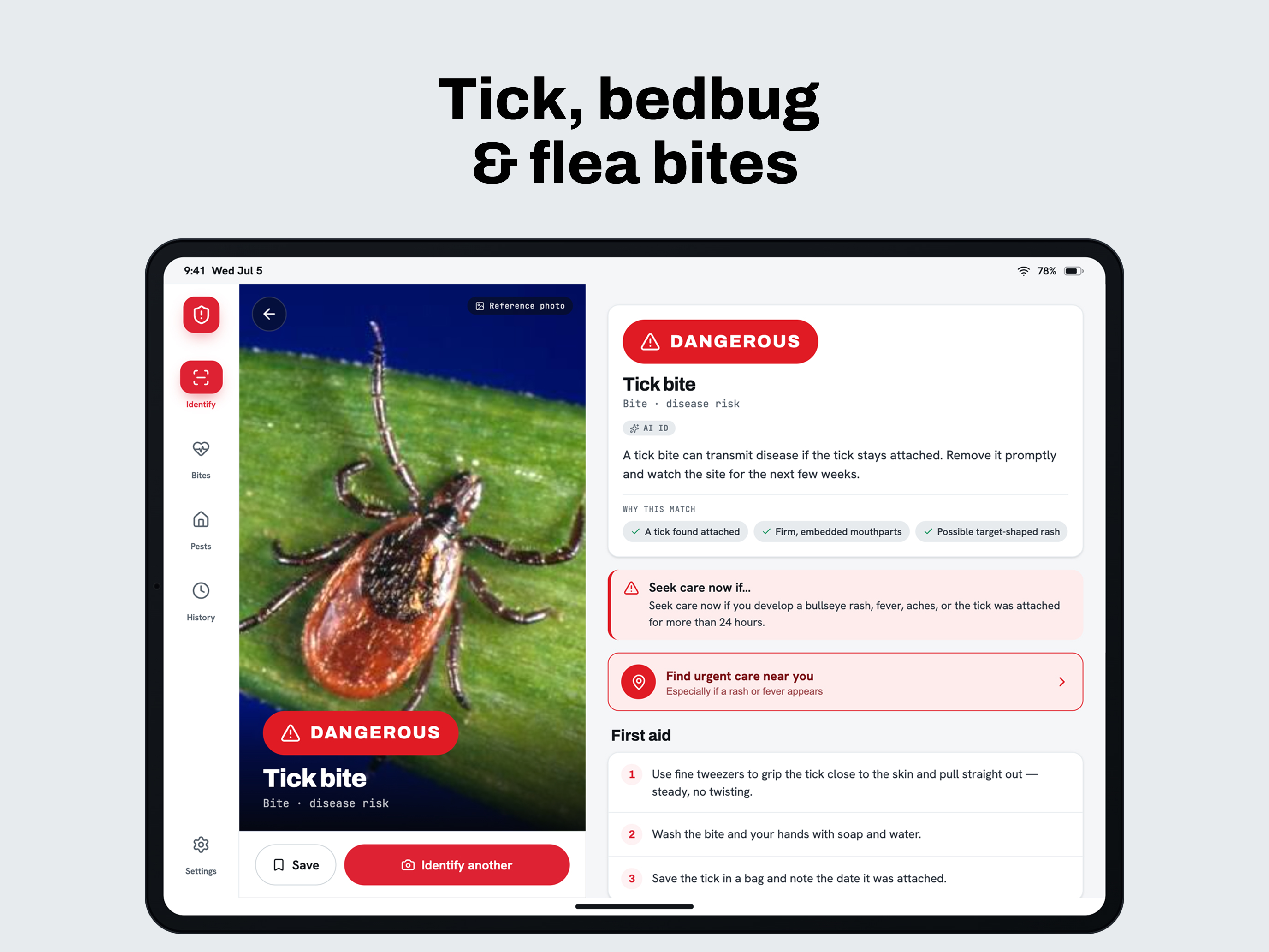 Bug Identifier: BugAlert screenshot 17