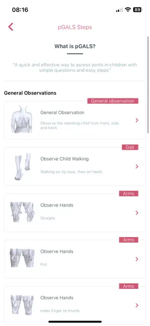 pGALS screenshot 2