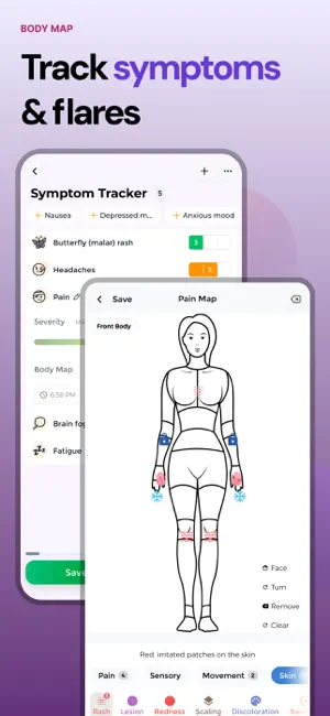Lupus Tracker screenshot 2