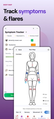 Lupus Tracker Screenshot 2 of 10