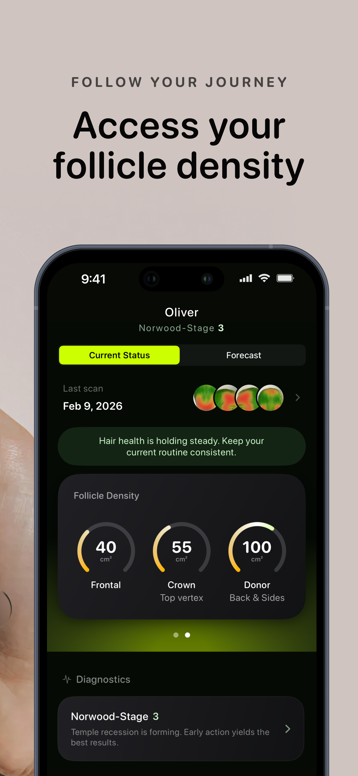 Baldy: Hair Loss & Health Scan