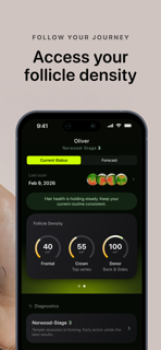 Baldy: Hair Loss & Health Scan screenshot 3