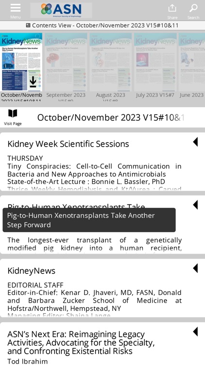 ASN Kidney News screenshot-4