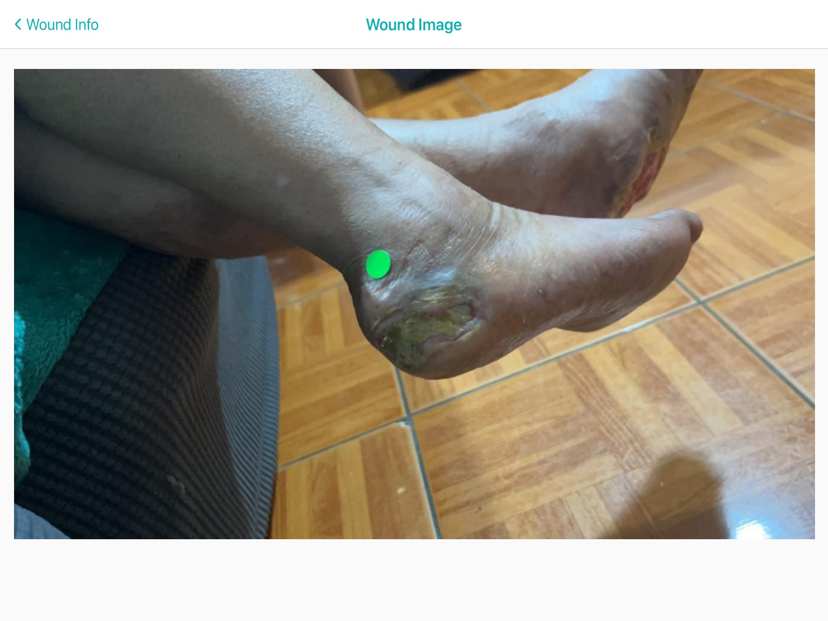 WoundMatrix Patient