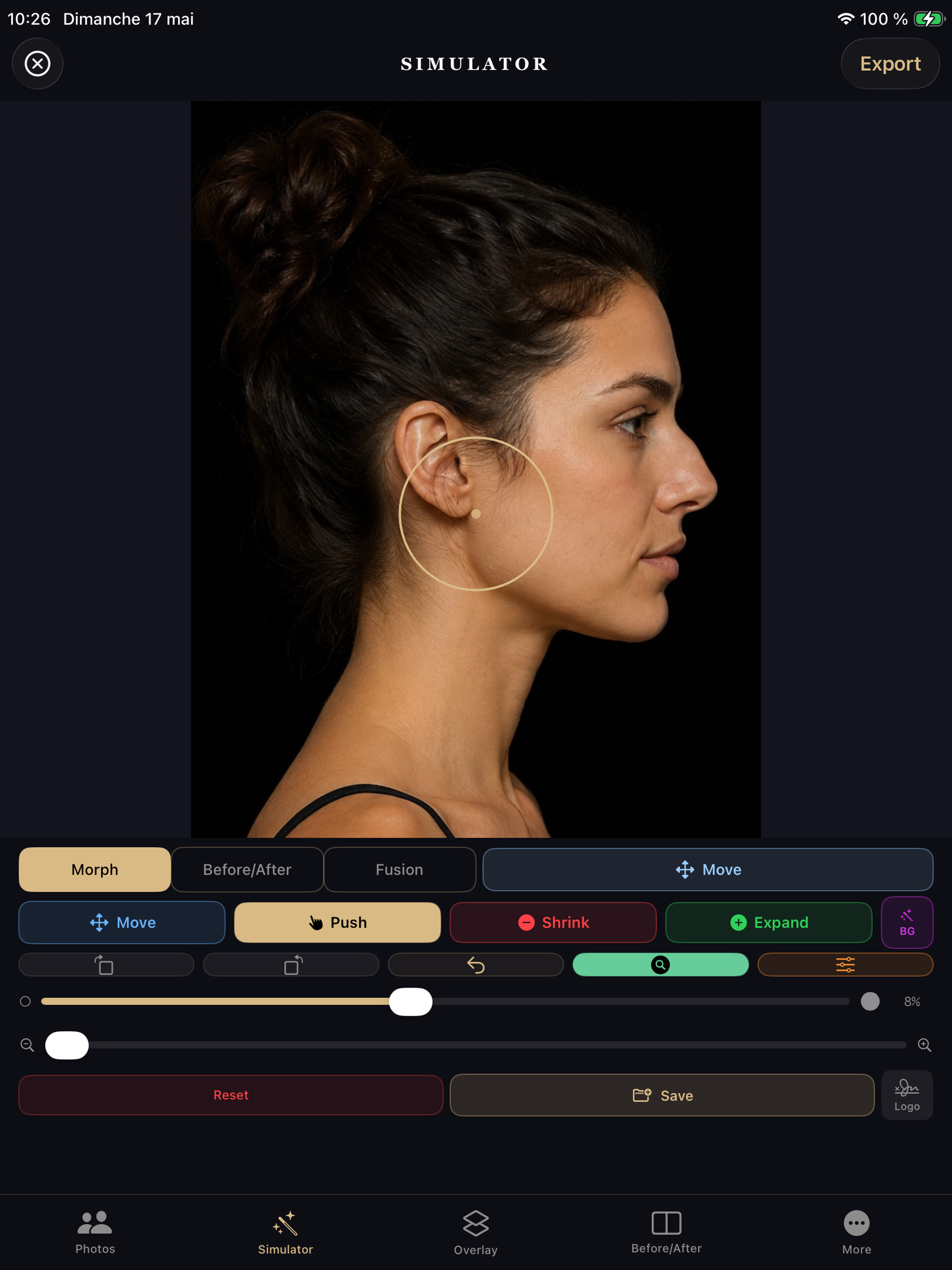 Rhinoplasty Simulator Pro