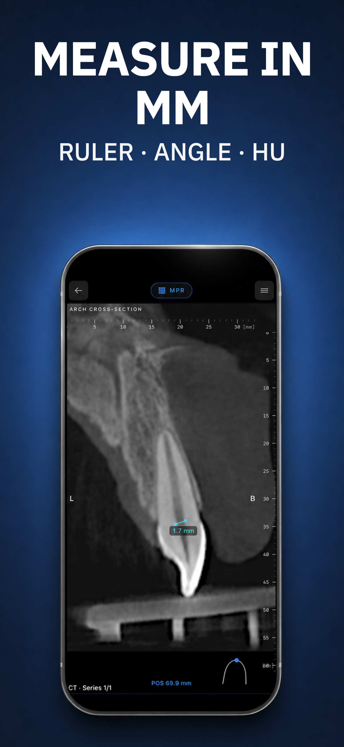 DICOM Viewer: MedScan CT MRI screenshot 5
