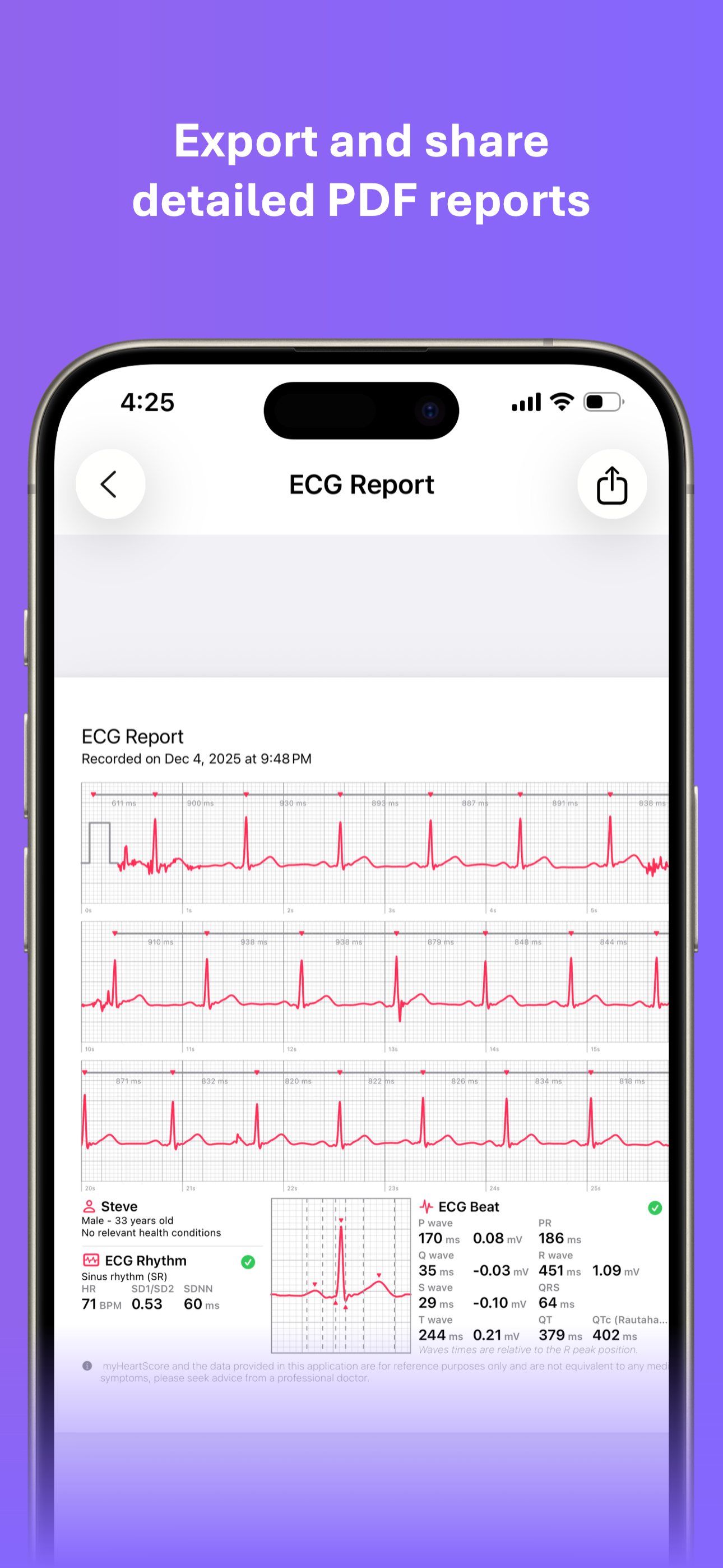 myHeartScore