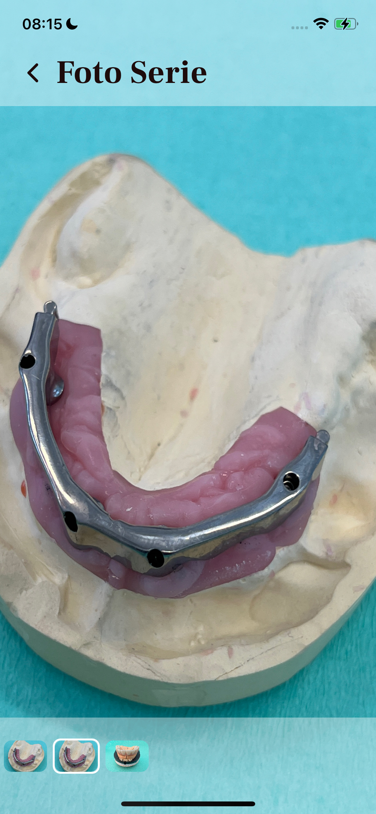 DentaSnap v2