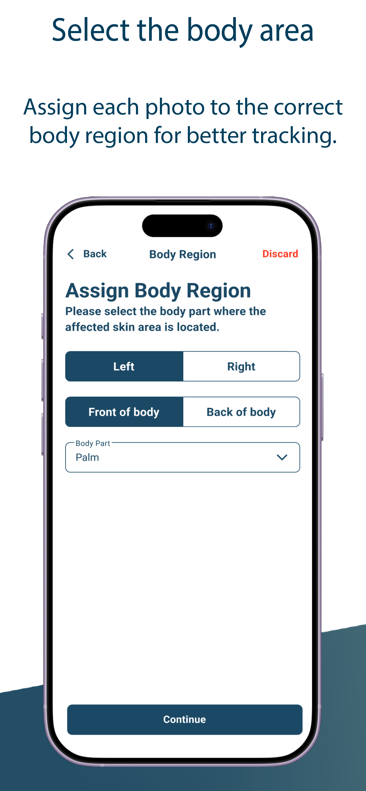 SkinAware