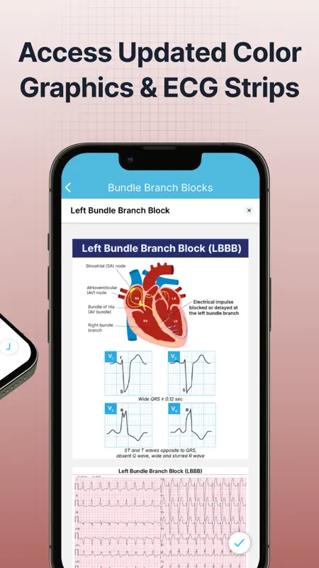 ECG EKG Interpretation Mastery screenshot 2 of 10