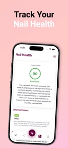 Nail Art & Design - CutieCure screenshot