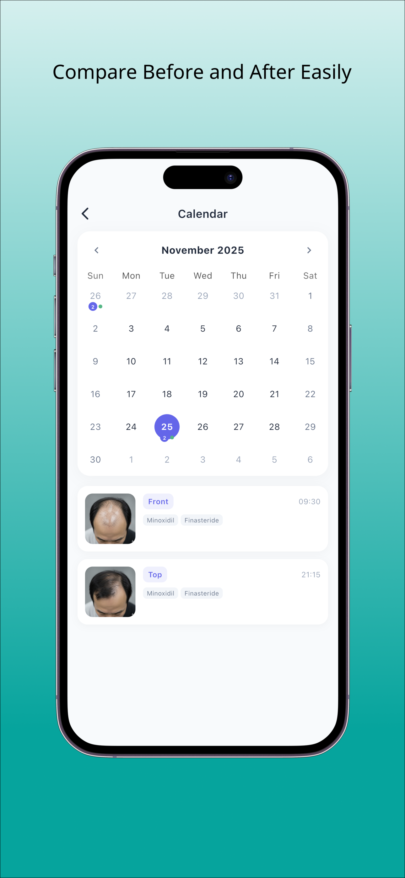 HairLog - Track Hair Change... screenshot 2