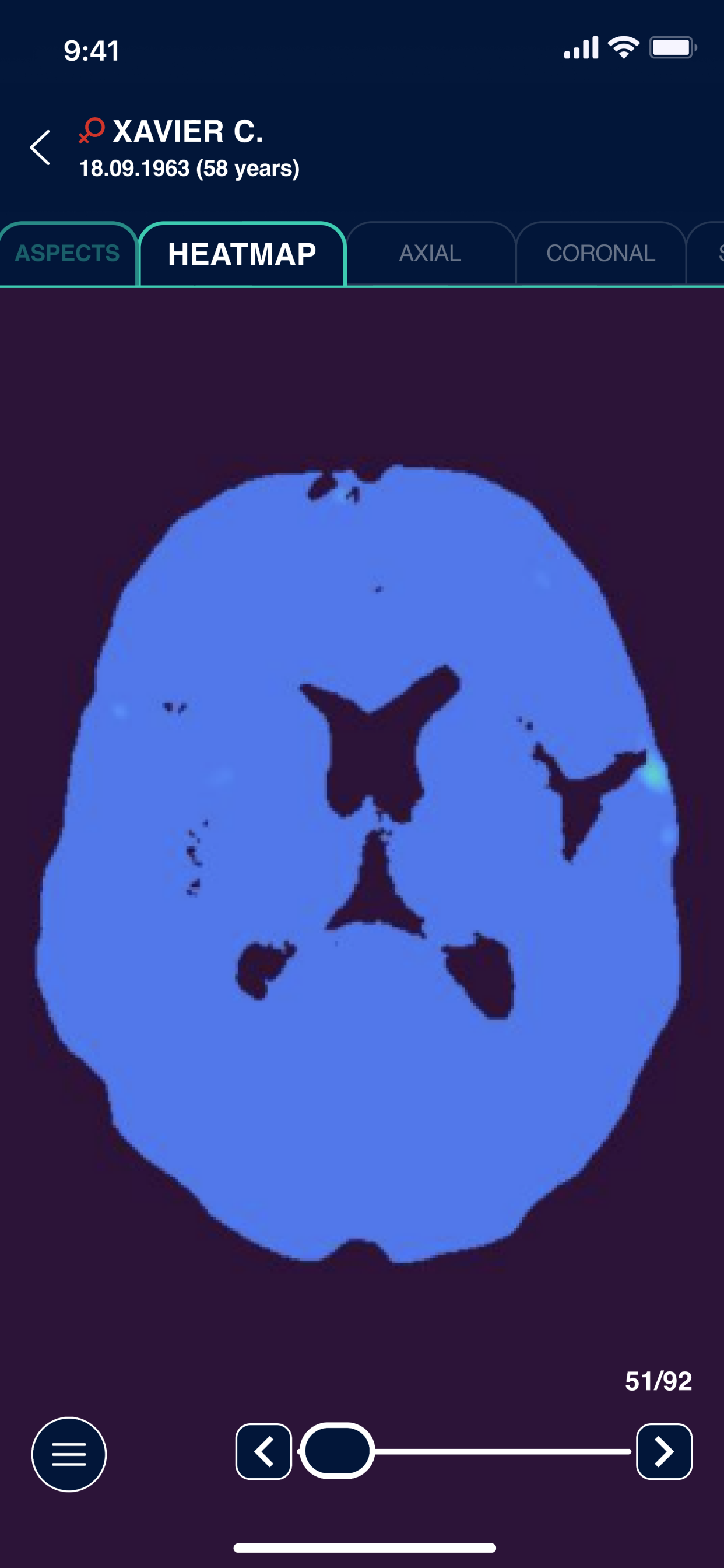 Cerebra screenshot 4