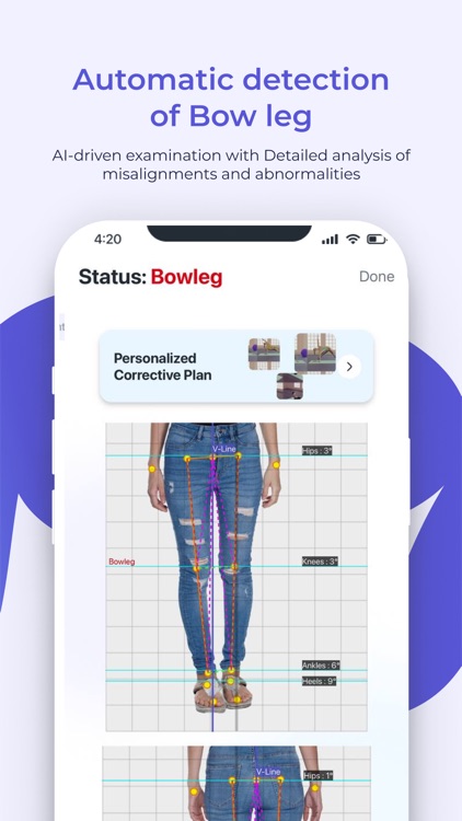 FlexiTrace Posture Analysis