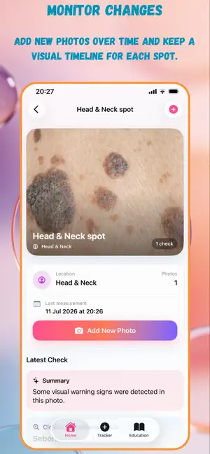 Skin Check: Mole Tracker screenshot 3