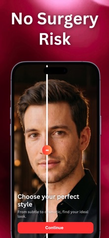 Lip Filler Simulator - Lipsy iPhone screenshot